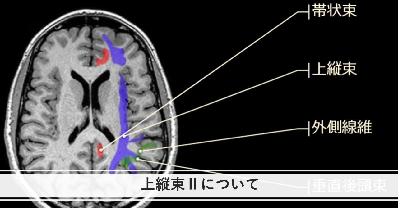 上縦束Ⅱについて｜くろ 作業療法士