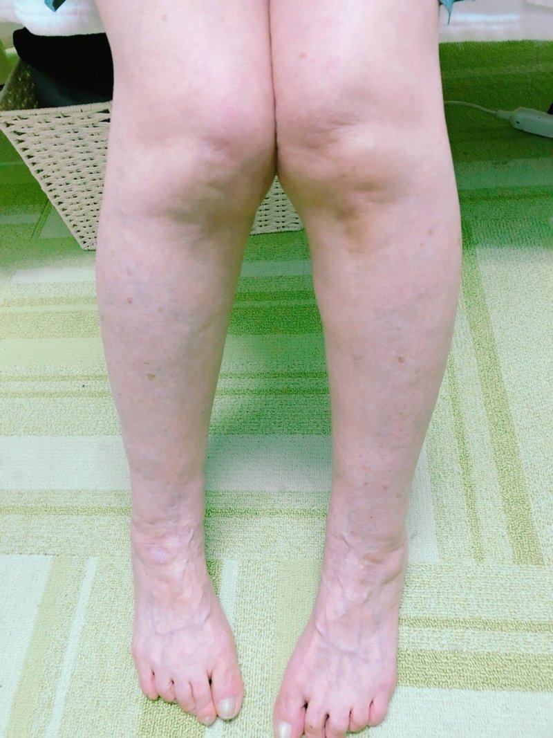 こんな思い込みは注意 自らo脚を酷くする残念な勘違い 竹内 Note こんな思い込みは注意 自らo脚を酷くする残念な勘違い 竹内 Note