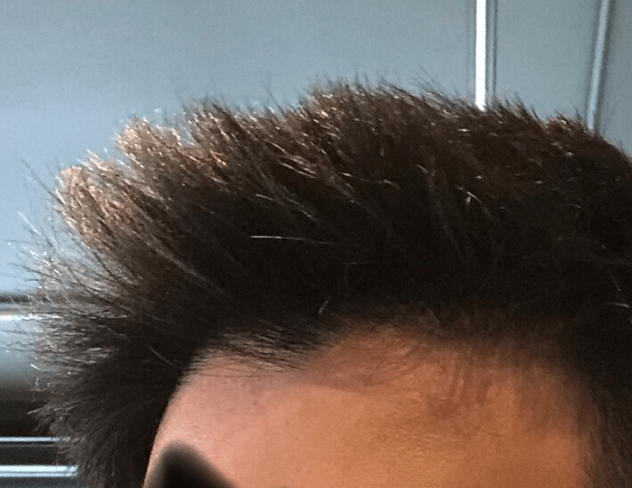 はじめての散髪 どうしてこうなった アイルランド留学 40日目 Nozumi Note