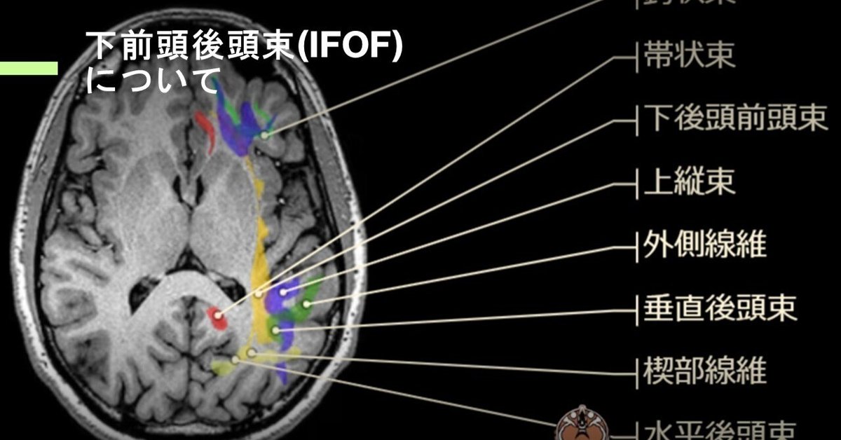 下前頭後頭束(IFOF)について｜くろ 作業療法士