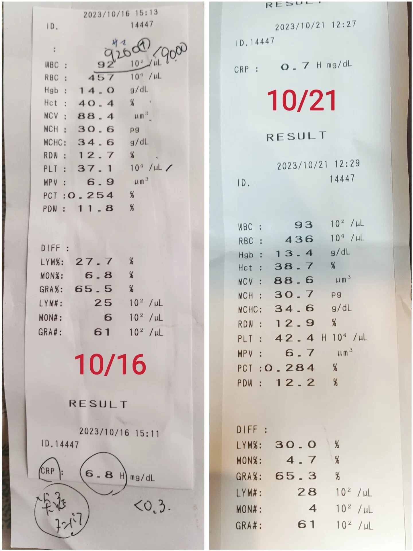 炎症 反応 血液 検査