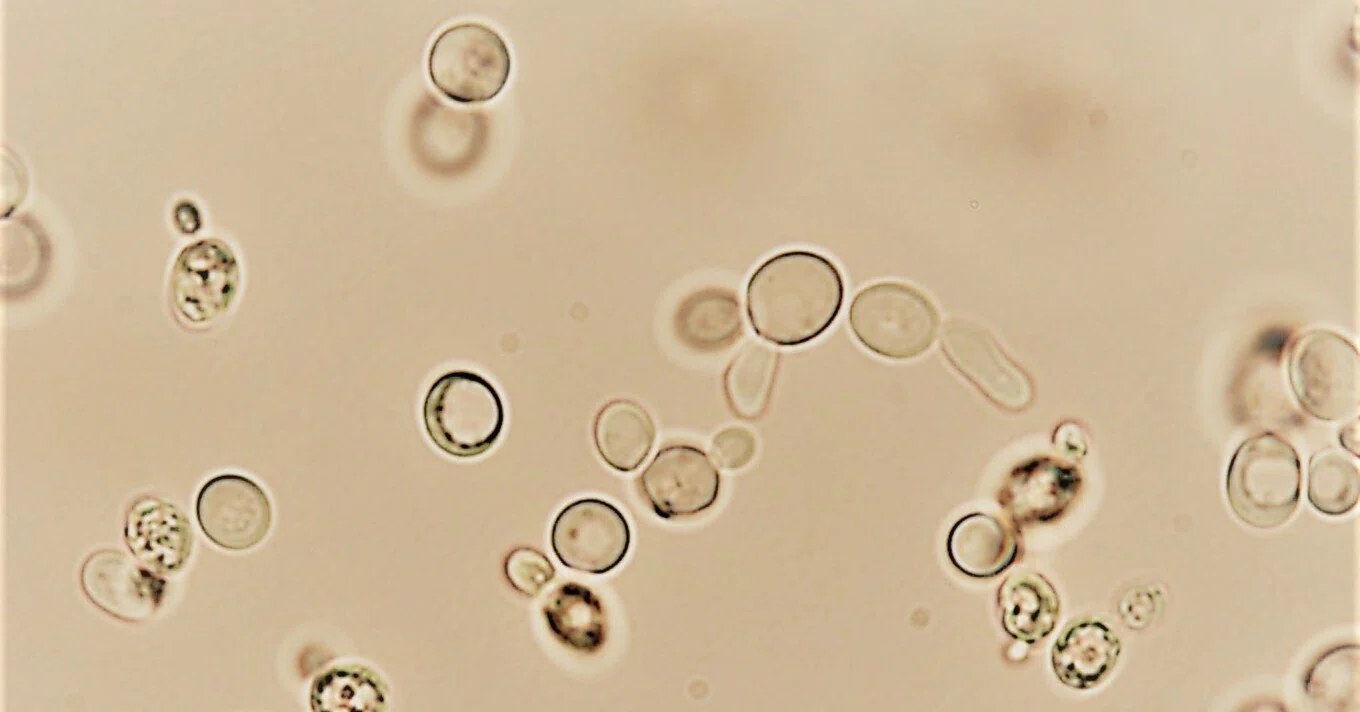 17】清酒醸造の微生物(1) -酵母④- (きょうかい酵母_4:その他の清酒用酵母)|正宗@酒造技能士