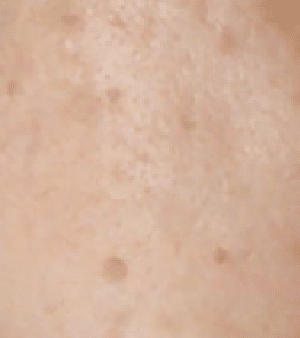 実際に購入 アルバニアベロを使った人が書いた口コミまとめ 良い口コミも悪い口コミも アルバニアベロ Note