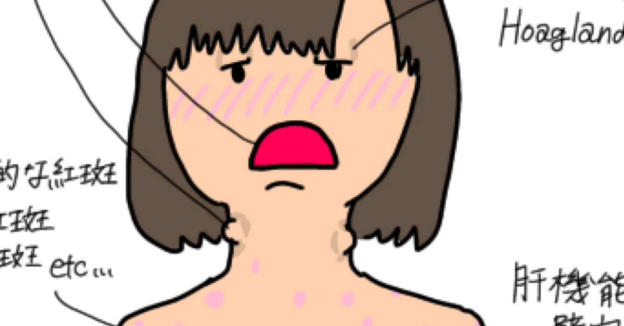 伝染性単核球症｜ぴぷか