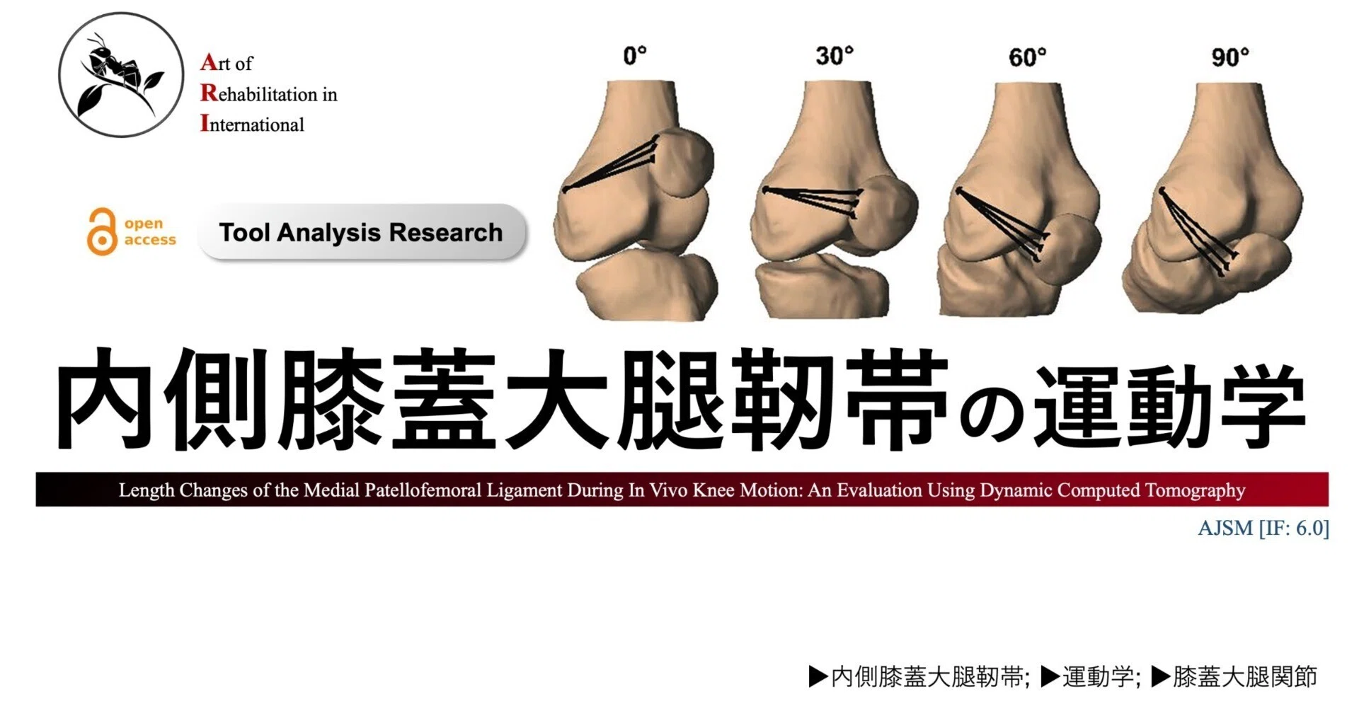 内側膝蓋大腿靭帯の運動学｜Super Human | 理学療法士／保健学博士 Ph.D.