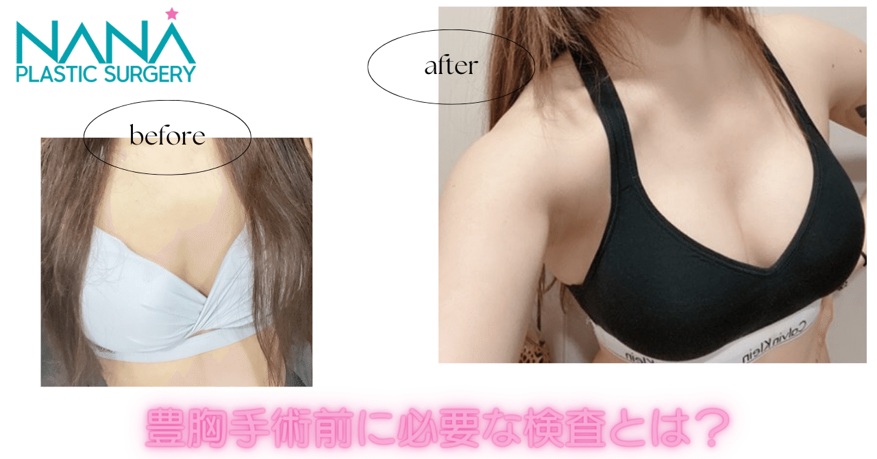 豊胸　術前 豊胸手術前に乳がん検診が必要な理由｜韓国整形NANA美容外科