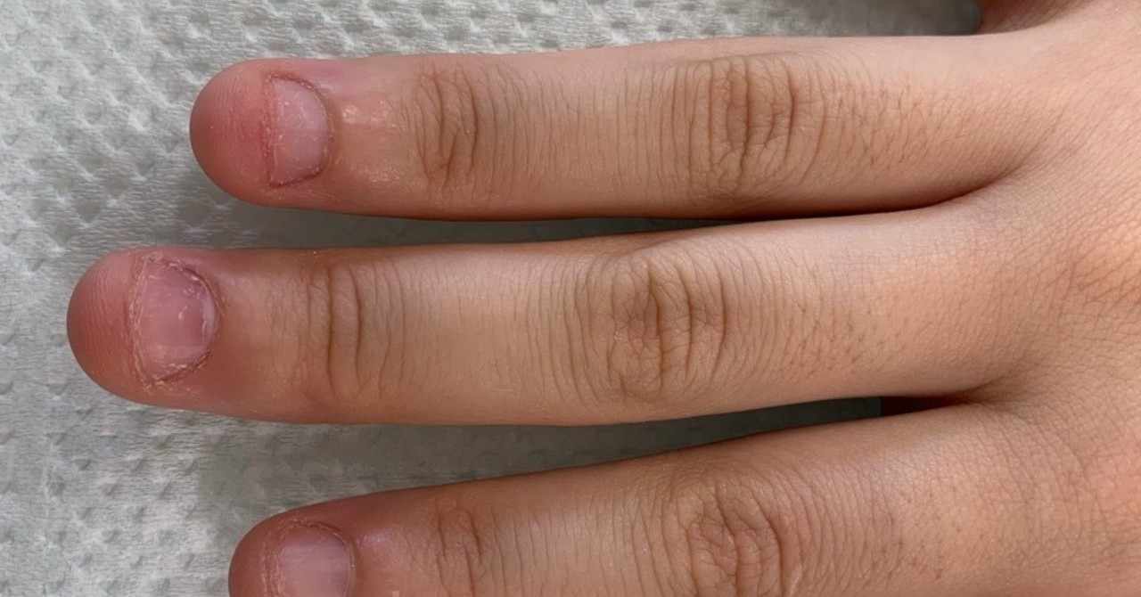 爪をむしる の新着タグ記事一覧 Note つくる つながる とどける
