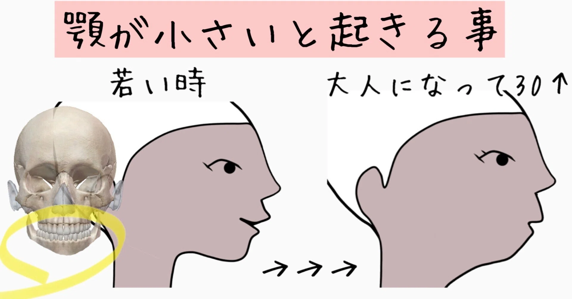 顎 が 小さい