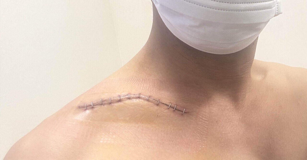 鎖骨のプレート