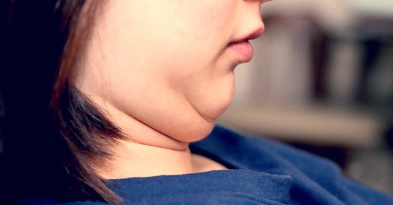 二重アゴ解消 Inner Peace Note