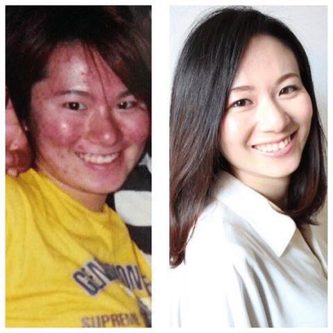 肌は自分でキレイになろうとする力を持っている エステティシャンのためのお勉強 Note