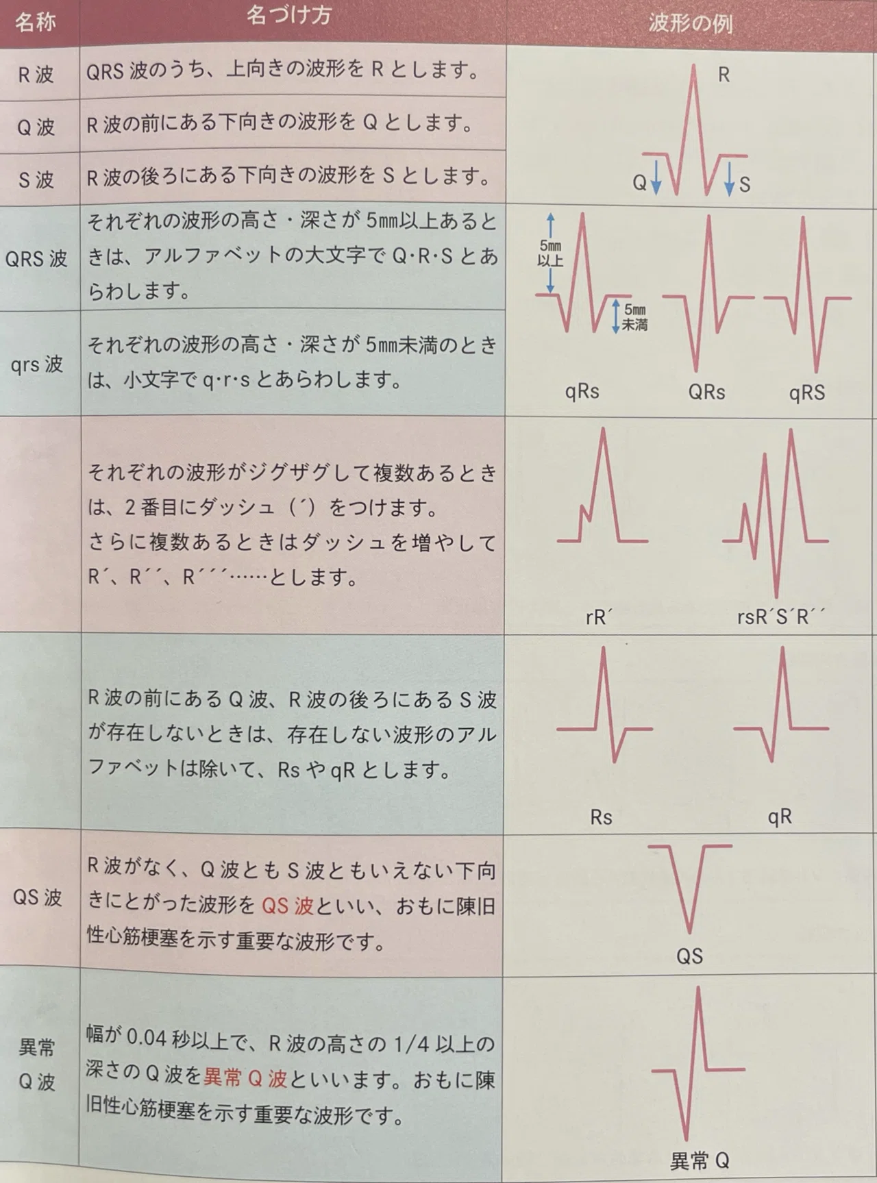 心電図 異常 波形 一覧