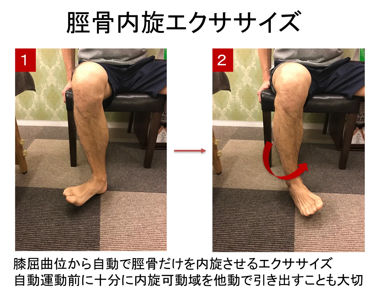 下腿外旋症候群についての評価・治療・パッド処方〜スクリューホーム