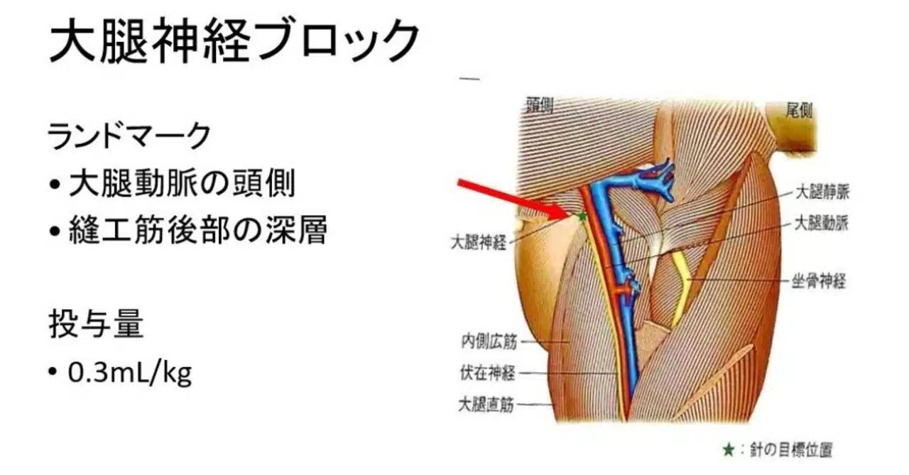 鼠径輪 の新着タグ記事一覧 Note つくる つながる とどける