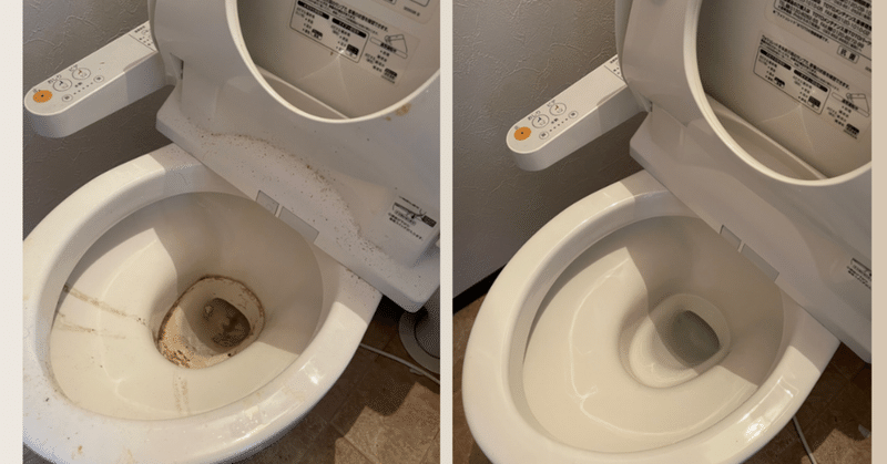 トイレのサボったリングの簡単な殺菌&掃除法