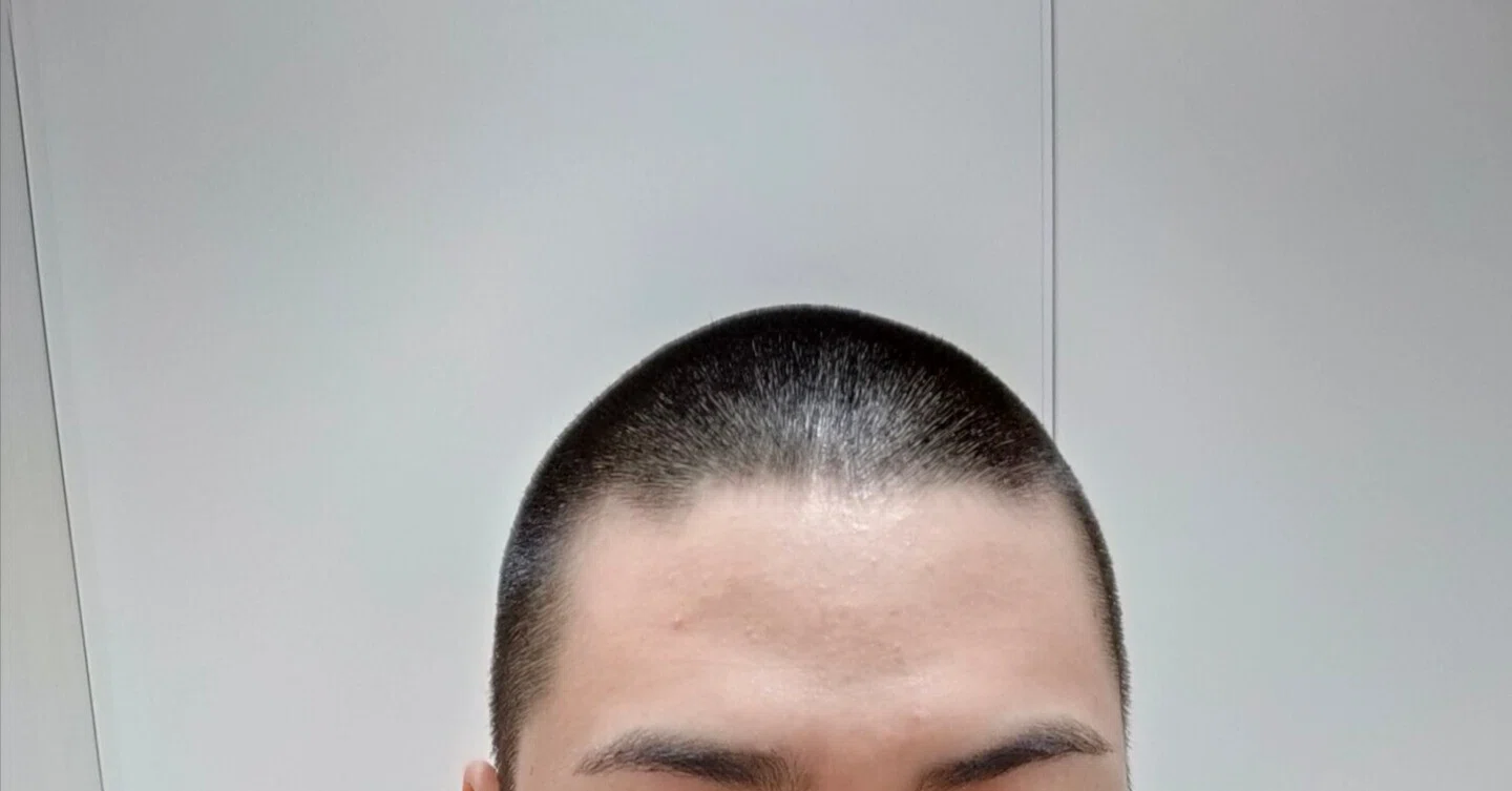 坊主 5 ミリ