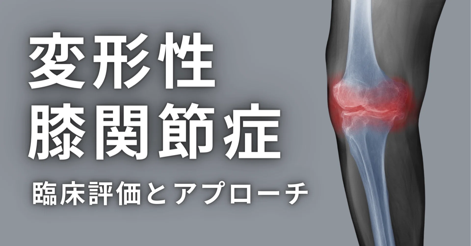 変形性膝関節症の臨床評価とアプローチ｜理学療法士による臨床のためのnote