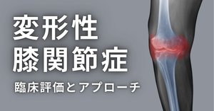 膝痛は改善できる？写真で見る膝のビフォーアフター10選｜O脚