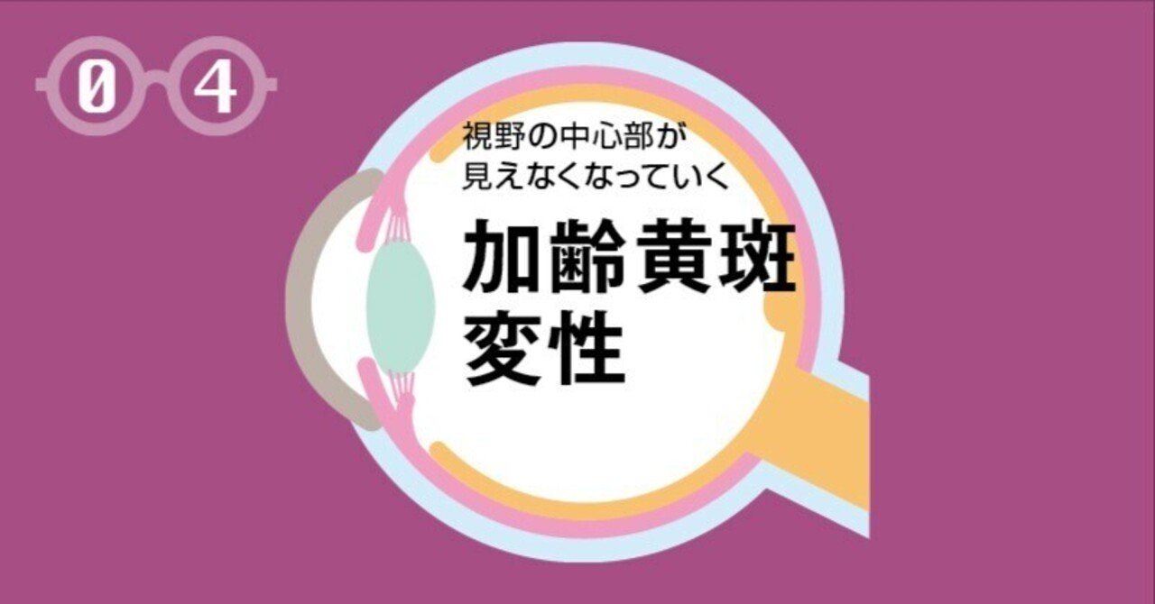 疾患の特徴と主な治療法解説】04 加齢黄斑変性～視野の中心部が