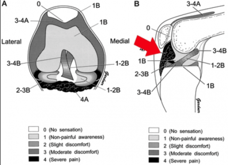 膝蓋下脂肪体について 福山 駿斗 Note