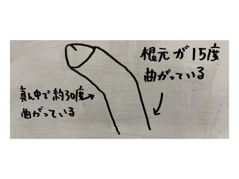 曲がったちんこを治す手術を受けました 曲がったちんぽが入らない 病院のサイトからでは分からなかったこと 実際にかかった費用 術前後のちんこのスペック 相談の連絡先 など書いています のでふ Note 曲がったちんこを治す手術を受けました 曲がったちんぽが入らない 病院のサイトからでは分からなかったこと 実際にかかった費用 術前後のちんこのスペック 相談の連絡先 など書いています のでふ Note