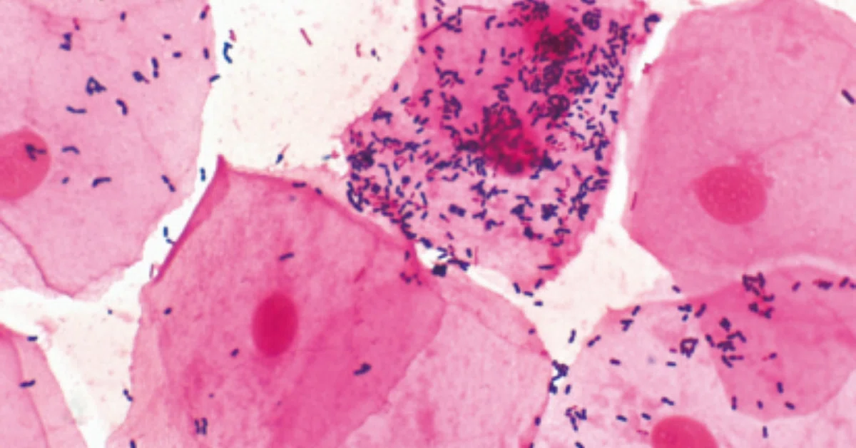 Microbiological Testing: A Close Call! (8)｜中外医学社Online