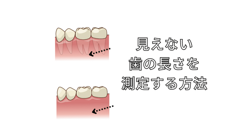 歯の根っこを治療する時、どうやって見えない先端の位置がわかるのか？
