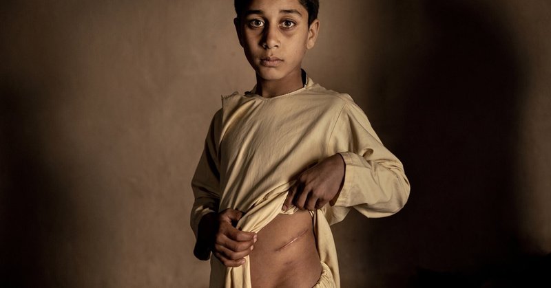 アフガニスタンの平和の代償：World Press Photo Story of the Year-2023