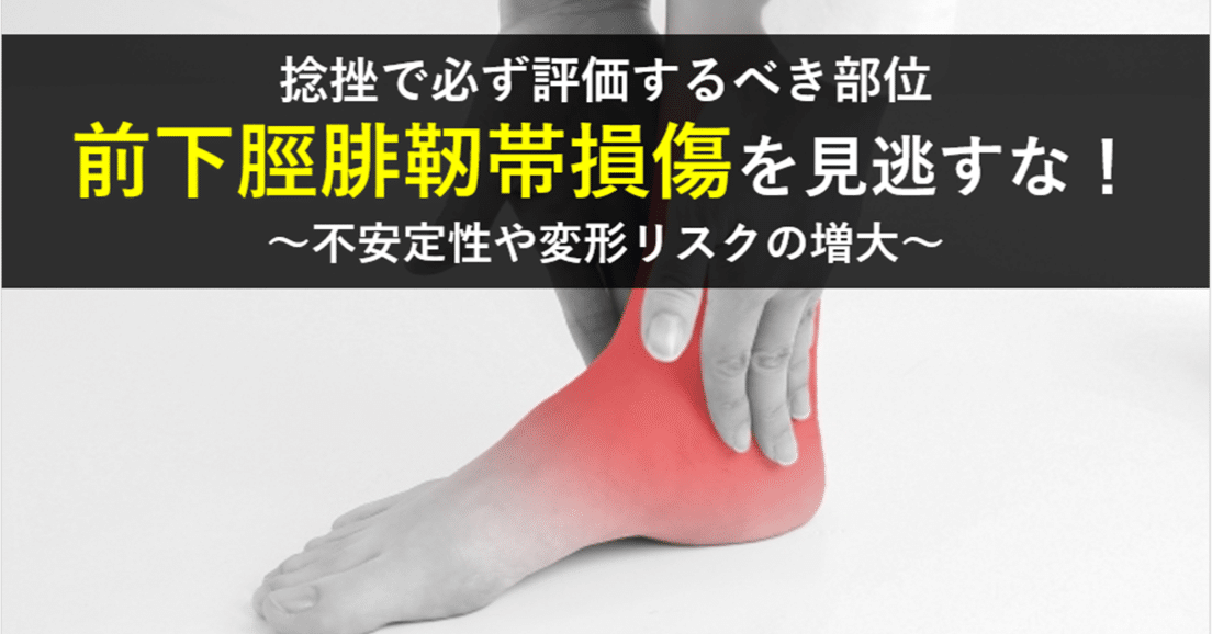 捻挫で必ず評価するべき部位 前下脛腓靭帯損傷を見逃すな
