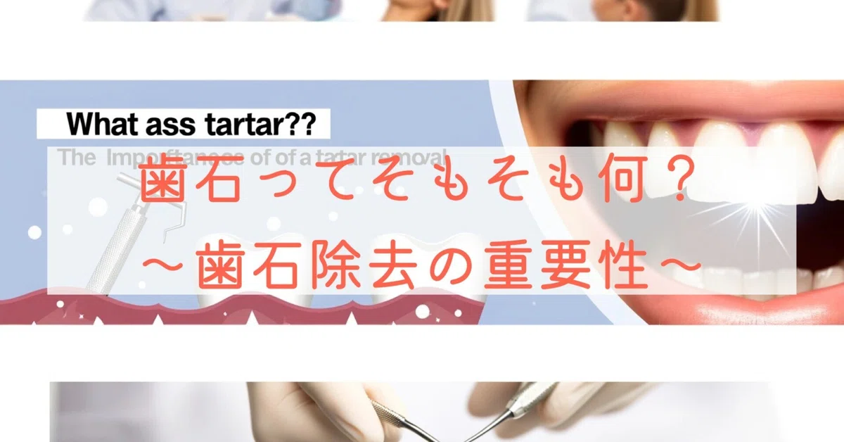 Teeth Extraction Types What exactly is dental calculus? ~The importance of dental calculus ...