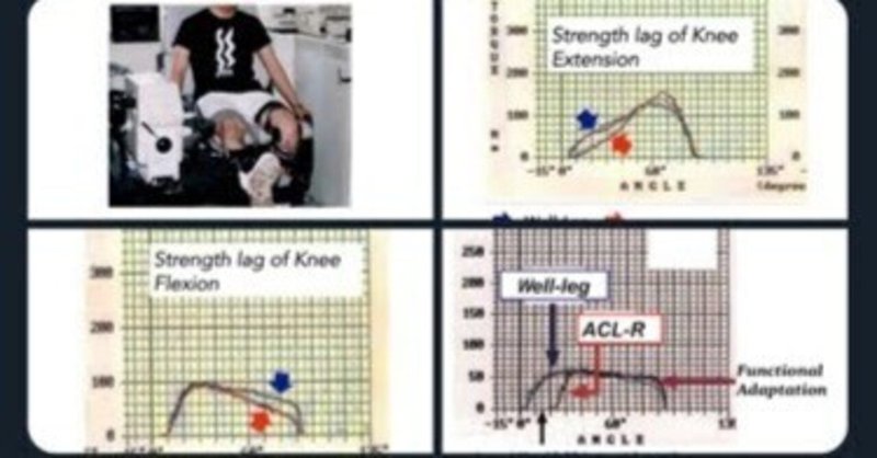 20240301 : 膝前十字靭帯損傷・等尺性最大収縮・筋力標準化・対称性比較・予防