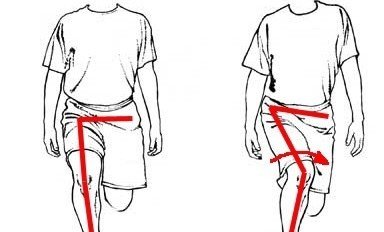 膝の痛みの原因にもなる ニーイン 膝の外反 が起こるメカニズム 中殿筋からの運動連鎖と内側広筋編 だーまえ Note