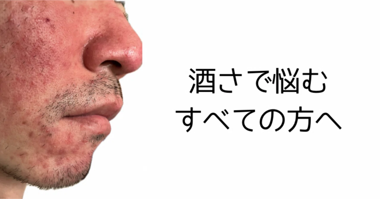 なぜ酒さが悪化した?|おぎ|らいぶケア