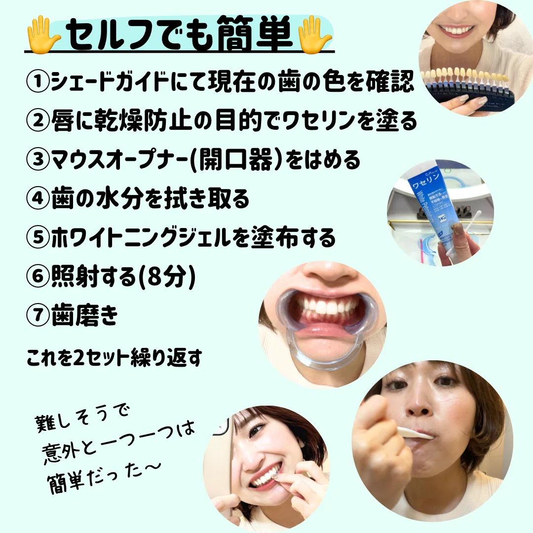 【未使用】セルフホワイトニング用　マウスオープナー　340個セット 一万円以下の歯科ホワイトニング専門店グロウ｜yui_nomy