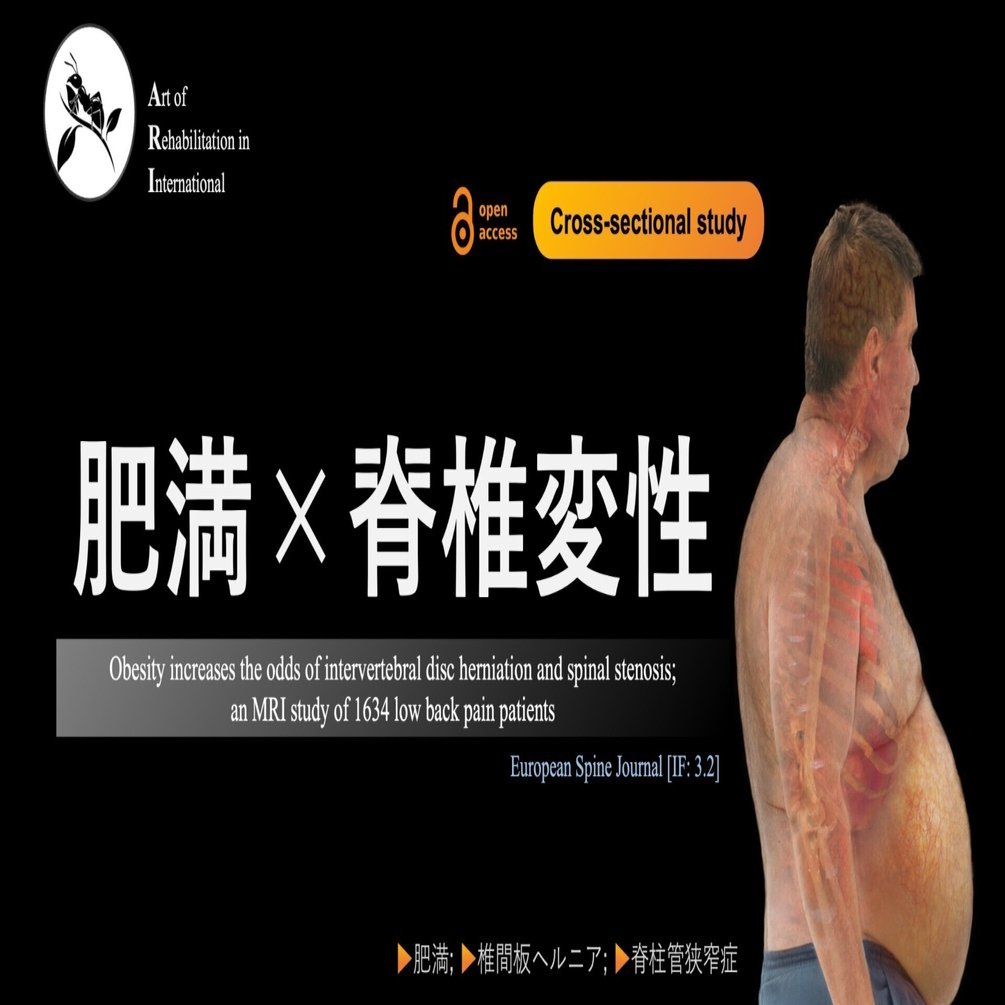 肥満×脊椎変性｜Super Human | 理学療法士／保健学博士 Ph.D.