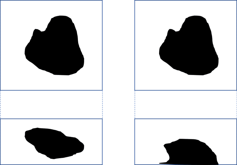 切り出し 病理が見える Note 切り出し 病理が見える Note