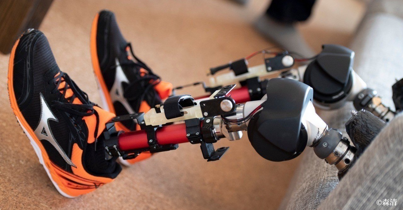 義足プロジェクト #24】 義足の「軽量化計画」に翻弄される身体。｜乙