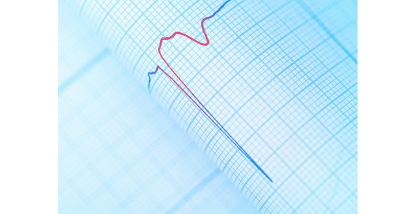 心電図➀　これってヤバい心電図！？