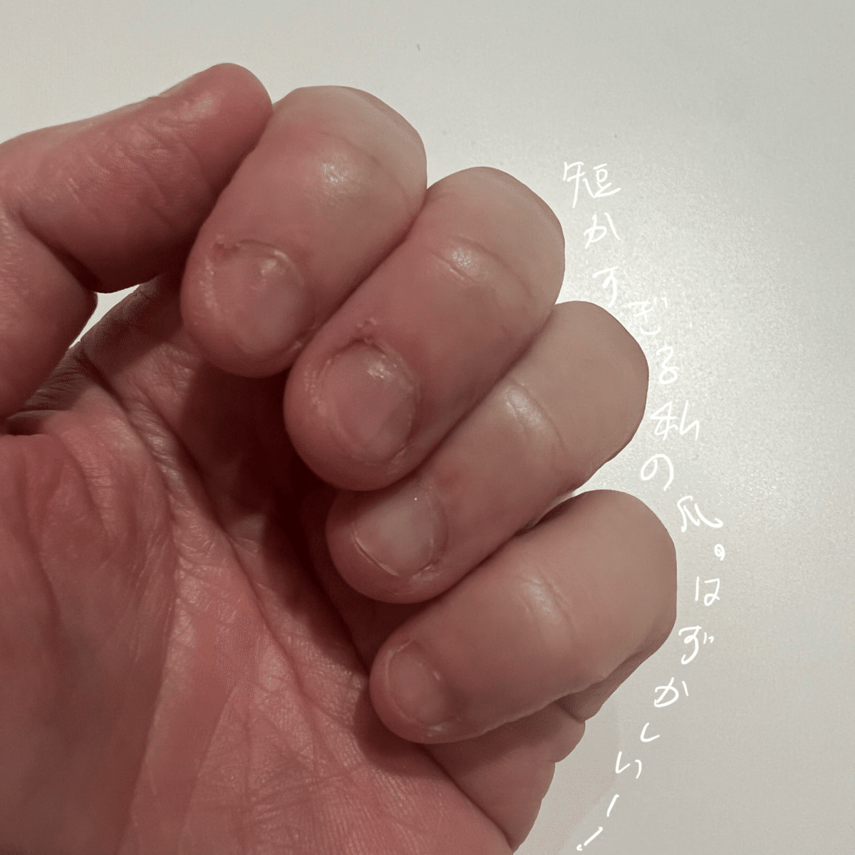 男子小学生 爪噛み ブログ 