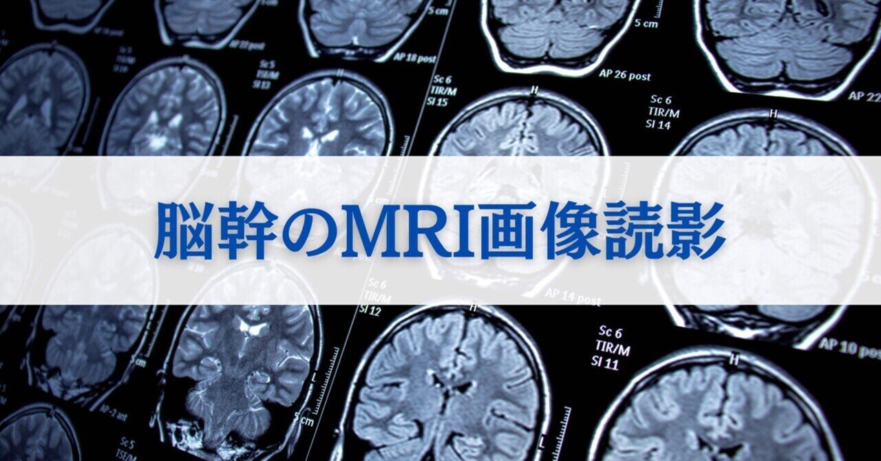 脳MRI 1.正常解剖 第2版 脳MRI 1(正常解剖) 第2版 脳MRI 1.正常解剖 | 高橋 昭喜
