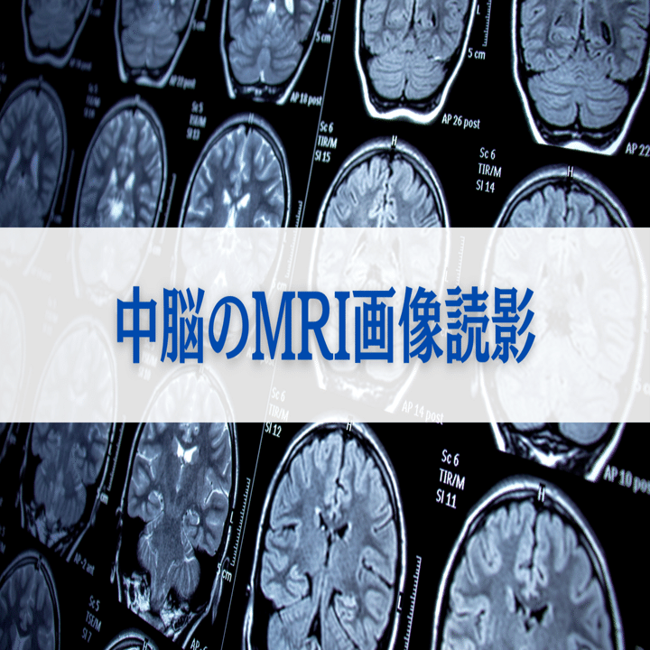 脳幹のMRI画像読影｜サギョウ先生