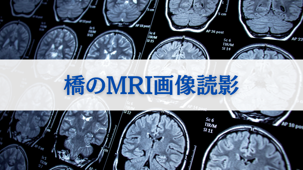 MR画像の原理―臨床のために A.L. ホロヴィッツ; 信一， 菅 脳幹のMRI画像読影｜サギョウ先生