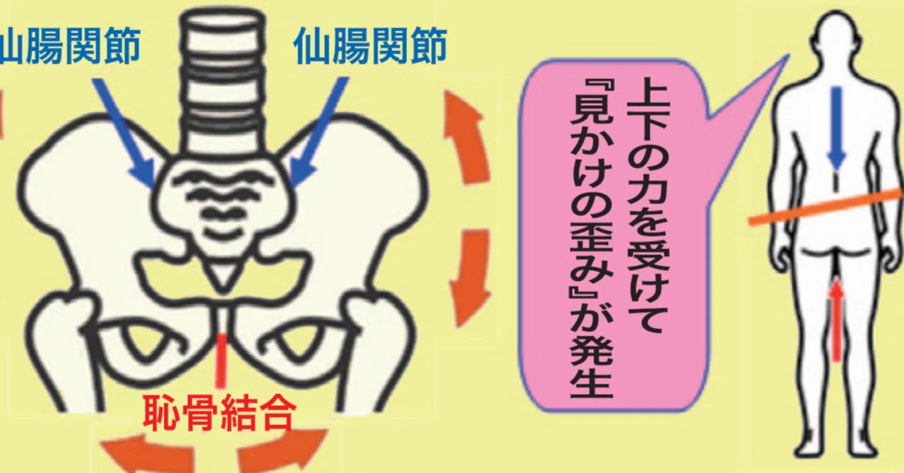 骨盤は歪みません!?④～「骨盤矯正」と「見かけの歪み」／連載コラム