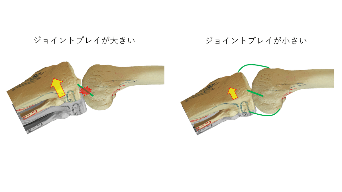 膝靱帯手術のすべて = Frontline of All Knee Ligam… 三条整形外科スポーツクリニック >> 口コミ情報 >> >> Anterior