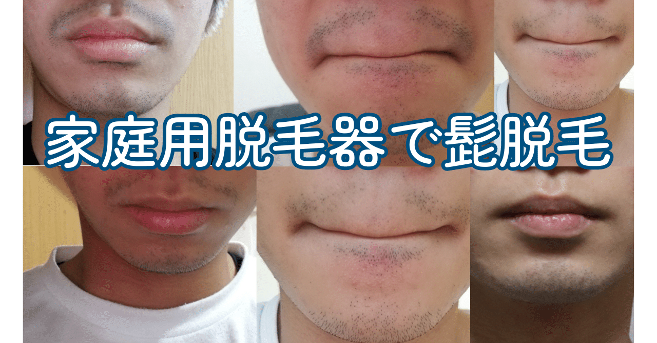 azu様専用 ケノン脱毛器 ver 6.0 ver.6.3 ケノン 眉毛脱毛器付き 脱毛