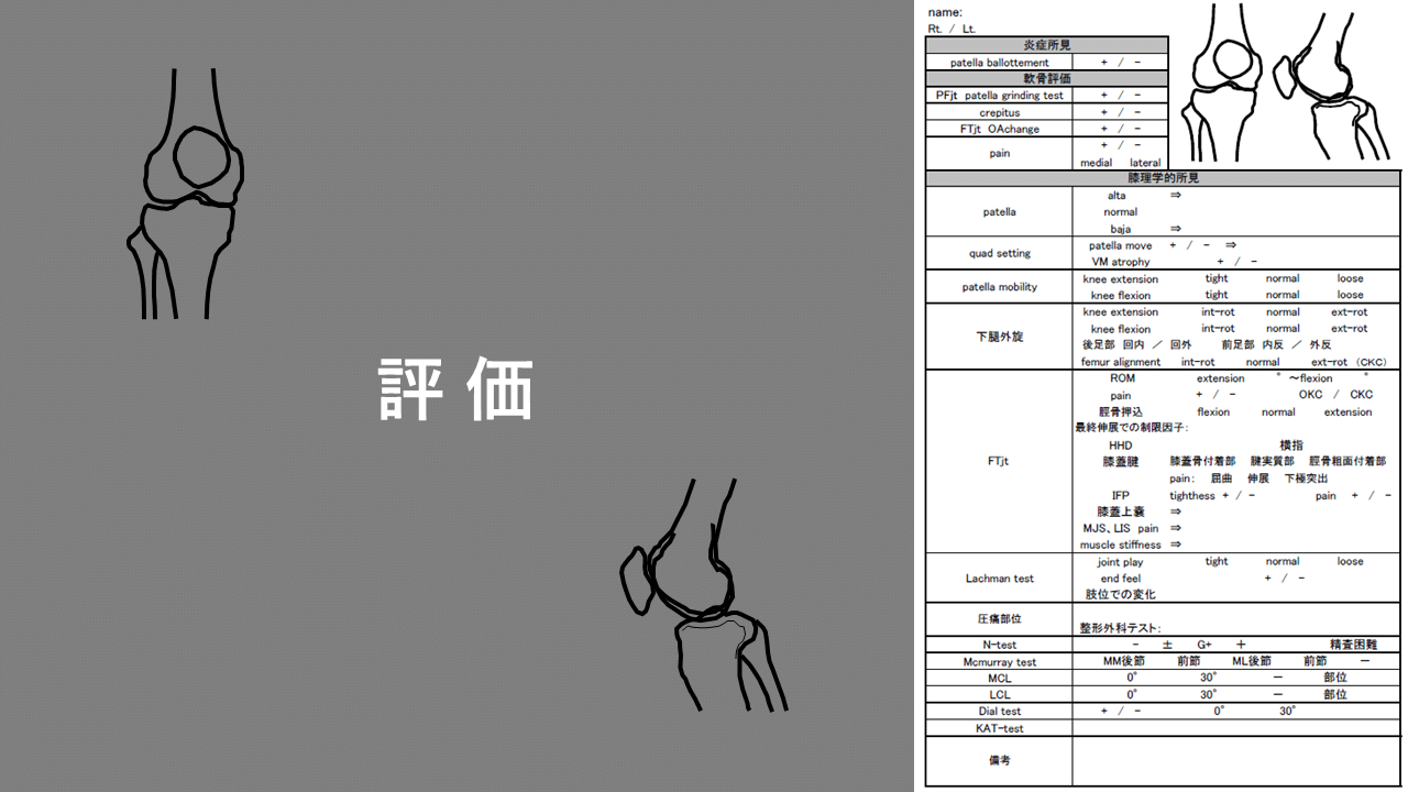 膝のスペシャルテストの重要性 No.3｜土屋元明のからだ改善チャンネル