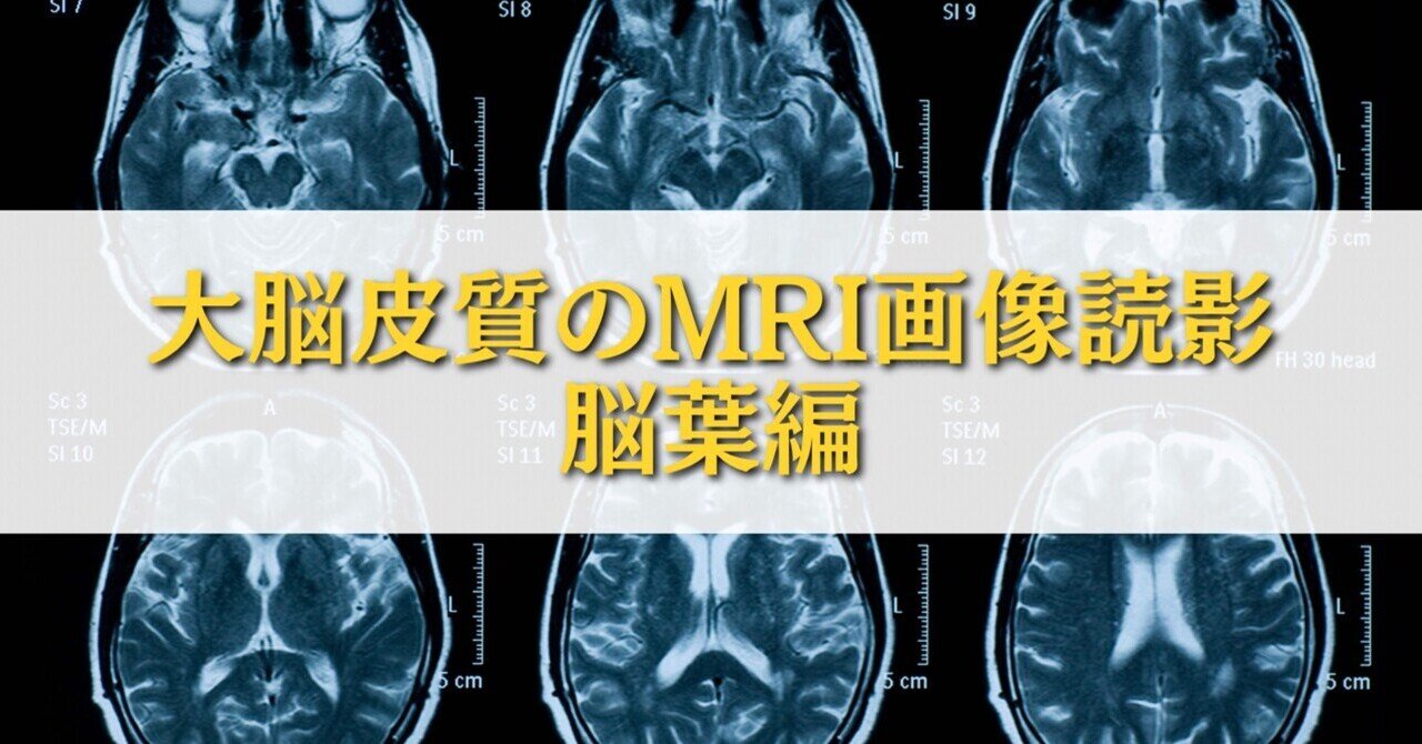 脳の形態と機能 : 画像医学の進歩 大脳皮質のMRI画像読影-脳葉編-|サギョウ先生