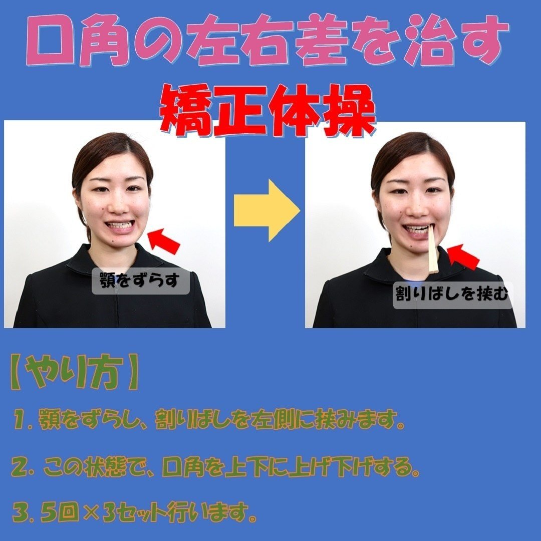 口角の左右差を治す割りばしを使った矯正体操のやり方 Revisionginza Note 口角の左右差を治す割りばしを使った矯正体操のやり方 Revisionginza Note