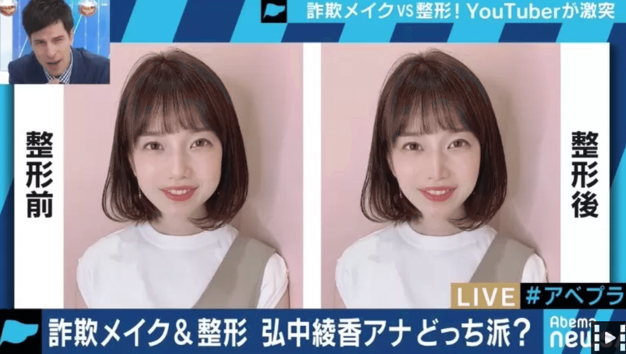 メイクだろうが整形だろうが 美しくみせたいなら 人を傷つけない手段であればいいじゃないですか 19 08 14 Abemaprime出演まとめ 松浦シゲキの曖昧なテキスト Note メイクだろうが整形だろうが 美しくみせたいなら 人を傷つけない手段であればいいじゃないですか 19 08 14 Abemaprime出演まとめ 松浦シゲキの曖昧なテキスト Note