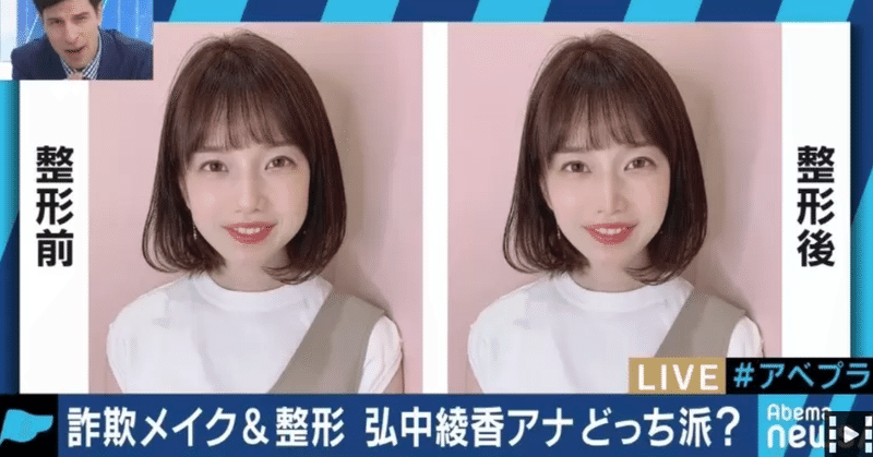 メイクだろうが整形だろうが 美しくみせたいなら 人を傷つけない手段であればいいじゃないですか 19 08 14 Abemaprime出演まとめ 松浦シゲキの曖昧なテキスト Note メイクだろうが整形だろうが 美しくみせたいなら 人を傷つけない手段であればいいじゃないですか 19 08 14 Abemaprime出演まとめ 松浦シゲキの曖昧なテキスト Note